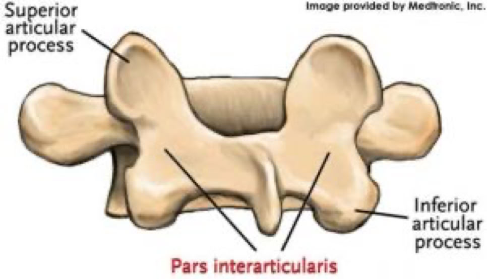 view from the back of the vertebra showing the pars